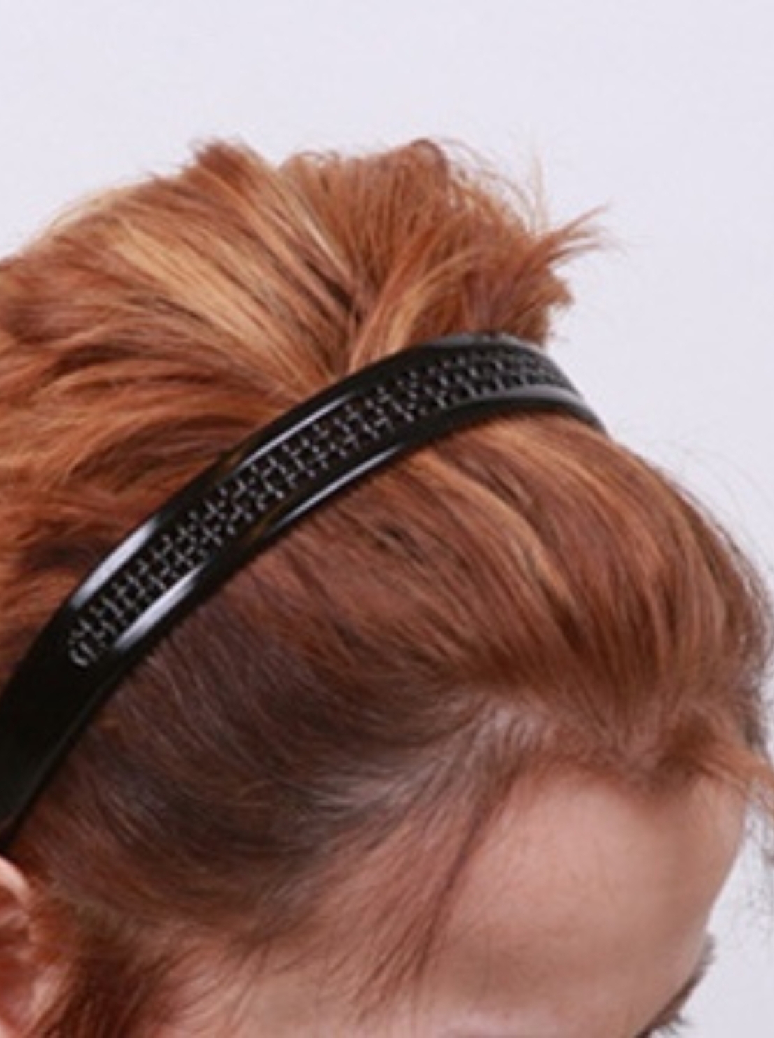 Hair Transplant